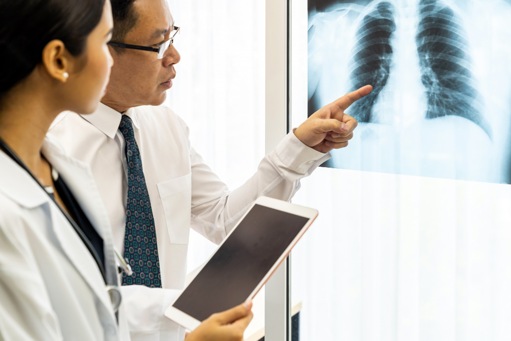 penyebab penyakit TBC pada paru-paru