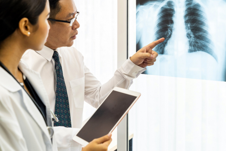 penyebab penyakit TBC pada paru-paru